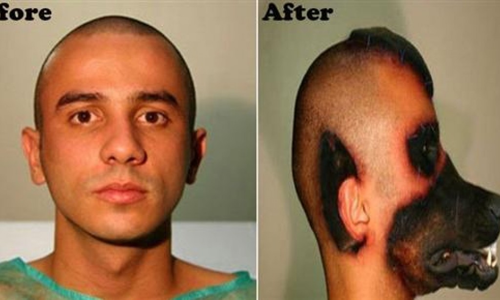 See this 5 plastic surgery that went too far.. After look is so scary