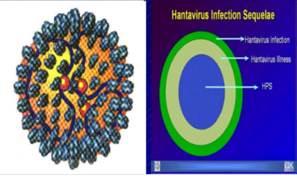 Hantavirus:another type of virus update from China